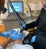 aplicacion clinica laser fraccionado 1 aplicacion clinica laser fraccionado 1