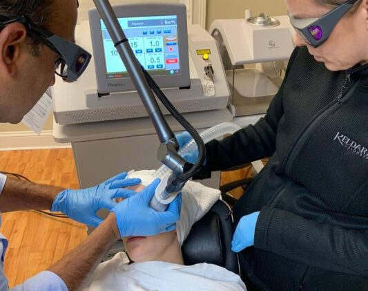 aplicacion clinica laser fraccionado 1 aplicacion clinica laser fraccionado 1