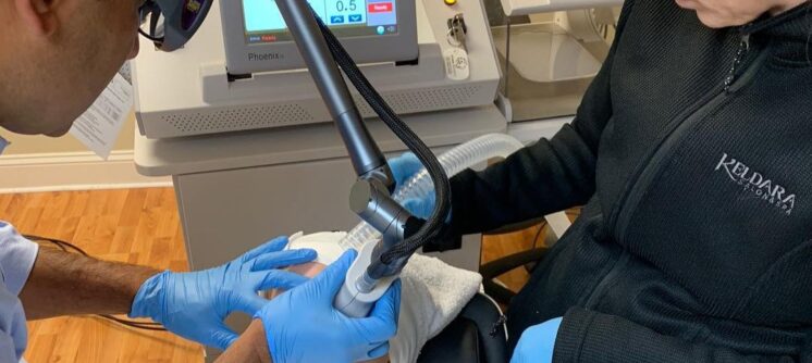 aplicacion clinica laser fraccionado 1 aplicacion clinica laser fraccionado 1